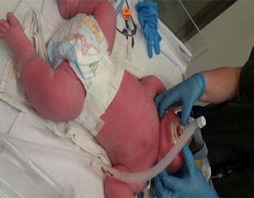 تولد نوزاد هفت کیلویی در نیوزیلند +عکس